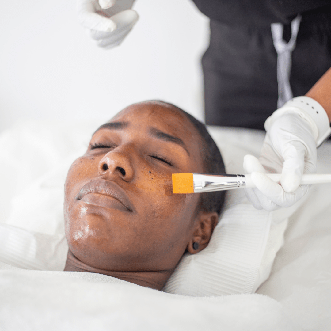 Chemical Peel Benefits - ML Aesthetic Clinic - ML Aesthetic Clinic