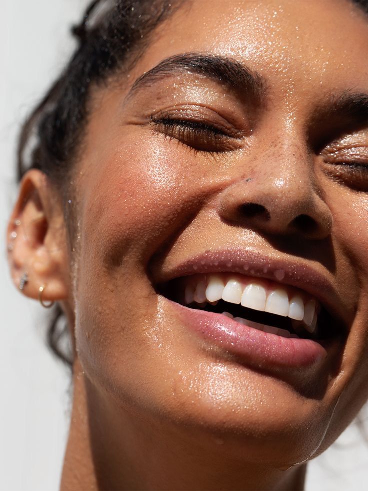 How a Holistic Approach Provides Long-Term Acne Solutions - ML Aesthetic Clinic