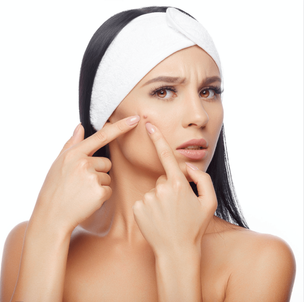 Advanced acne treatment  - ML Aesthetic Clinic